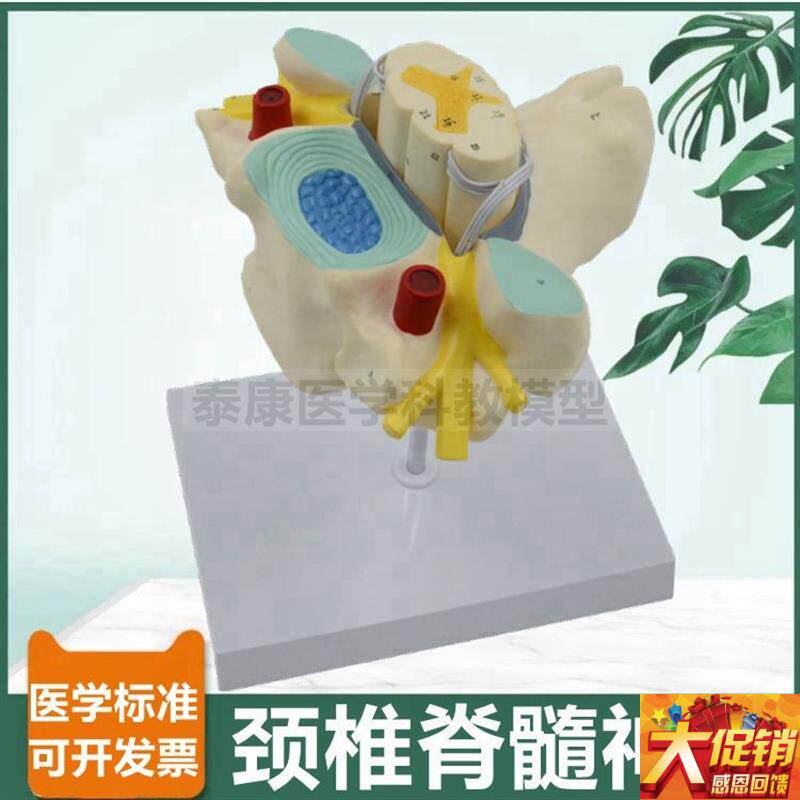 颈椎脊髓模型脊神经根交感神经椎管蛛网膜硬脊膜临V床麻醉医生教