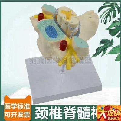 颈椎脊髓模型脊神经根交感神经椎管蛛网膜硬脊膜临V床麻醉医生教