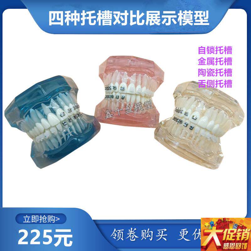 牙科正畸模型f 4种托槽对比模型 金属 陶瓷舌侧自锁托槽示范模型
