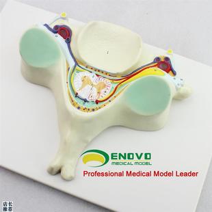 颐诺正品第五颈椎脊髓s和脊神经放大模型脊髓横断解剖颈椎模型