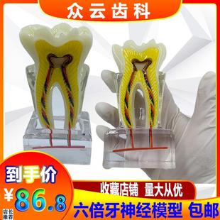 口腔牙科教学教j具6倍牙神经模型水晶牙齿结构造解剖医患沟通包邮