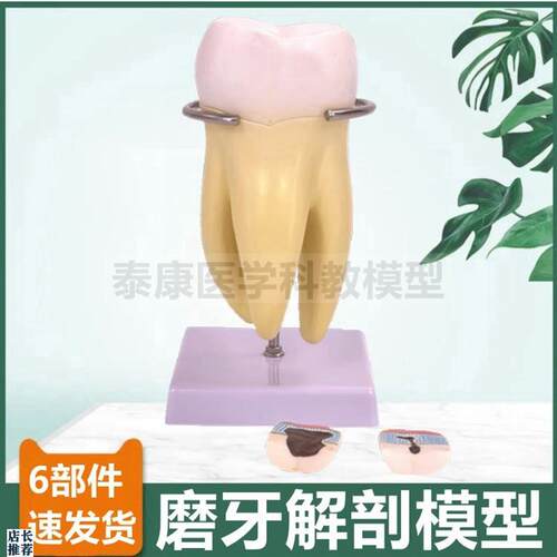 牙齿模型切牙尖牙磨牙拆卸口腔牙医牙科J教学标本龋齿蛀牙发展过