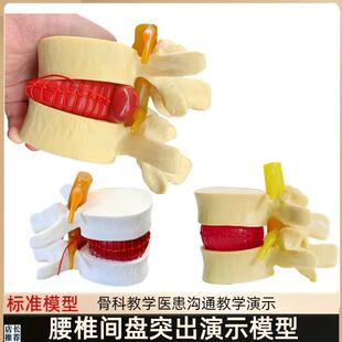 人体脊柱模型脊椎骨头腰椎间盘y模具椎体模型突出受压病理骨质教
