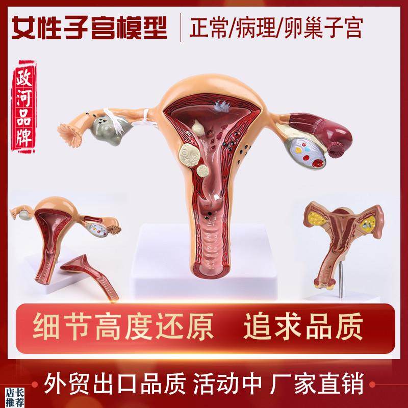 人体模型女性生殖病理子s宫阴道卵巢医用教学模具病理变化培训器