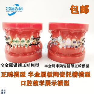 齿科口腔教学模型半金属半陶z瓷托槽正畸模型错颌矫正正畸模型