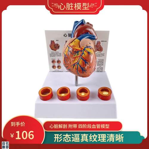 人体心脏模型四阶段血栓可拆卸B冠状动脉心血管血液循环解剖器官