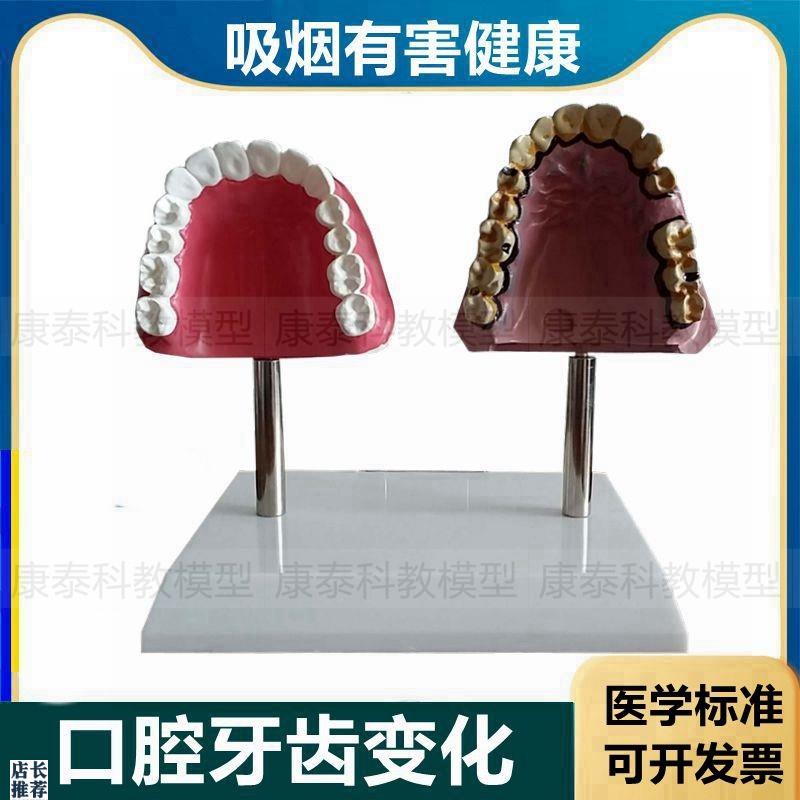 烟民牙齿吸烟危害口腔健康科普展示禁烟场所O摆件戒烟宣传教育模