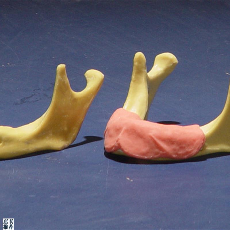 ENOVO颐诺下颌骨种植操作模型口F腔种植口腔齿科培训实训操作模