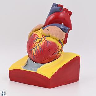 人体心脏模型心血管主动脉瓣膜心房上腔静脉B超T影像教学内脏模具