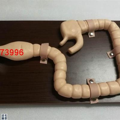 乙状结肠镜检查模型大肠J肠道病变检查模型