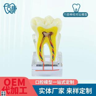 牙科口腔6倍神经线教学模型蛀牙龋F坏发展演示成人病理模型牙展示
