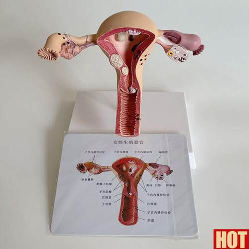 理子宫模型女生殖肌层输卵管卵巢妇科常见病理Y医药促销跨境热卖