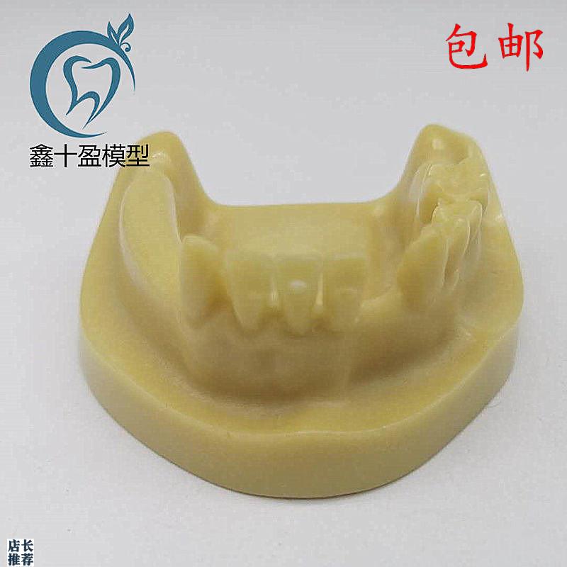 牙科材料下半口种植练习模型发泡缺失种植练O习教学模型M2028