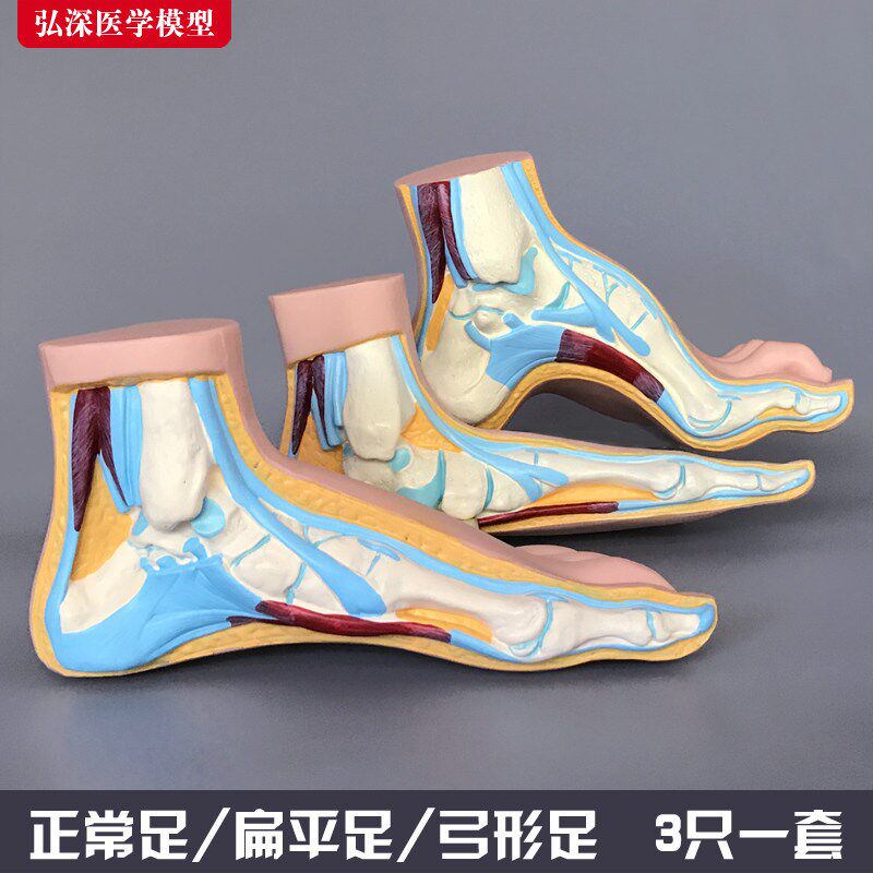 脚模型正b常足扁平足弓型足解剖人体脚部构结构造肌肉血管医学模