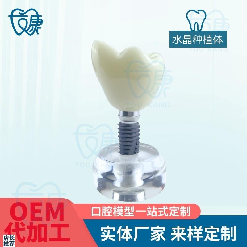 水晶种植体模型透明牙科模型教学医患沟通模型诊室W摆件齿科材料