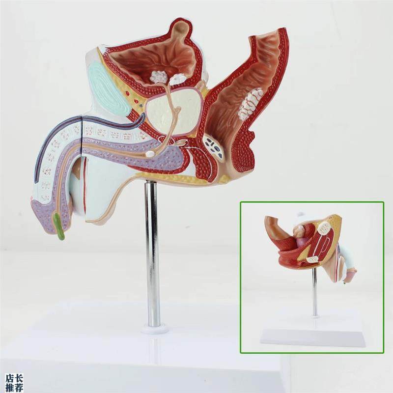 病理男性内外生殖m解剖模型病变生殖解剖模型男泌尿系统疾病模型