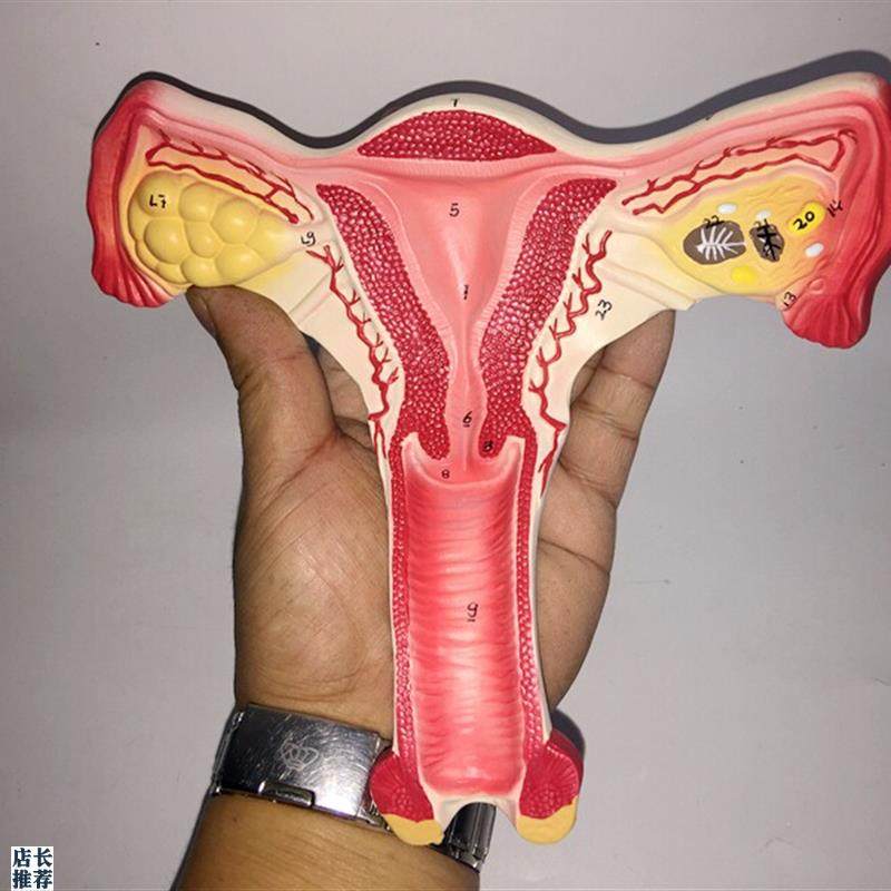 人体模型女性生殖子n宫模型生殖卵巢模型教学模具病理变化科学教