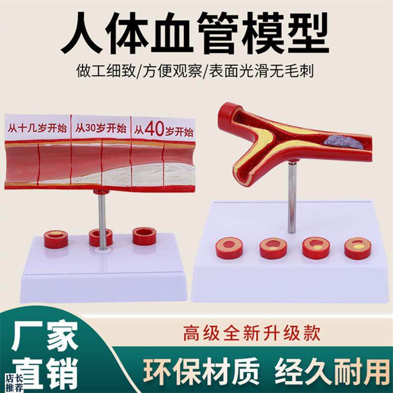 动脉性心血管冠状模型硬化动脉C模型老年心脏模型形成血栓模型