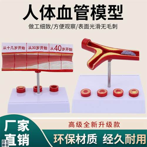动脉性心血管冠状模型硬化动脉C模型老年心脏模型形成血栓模型