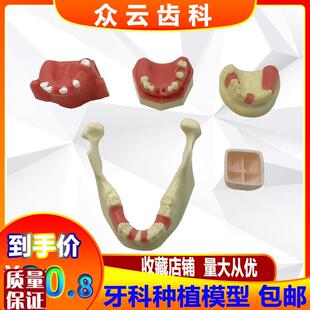 上颌窦提升操练模型种植牙练习模H型口腔种植软牙龈齿科材