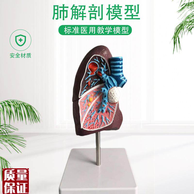 医用人体病理肺模型内科模型肺F模型肺解剖呼吸系统模型包