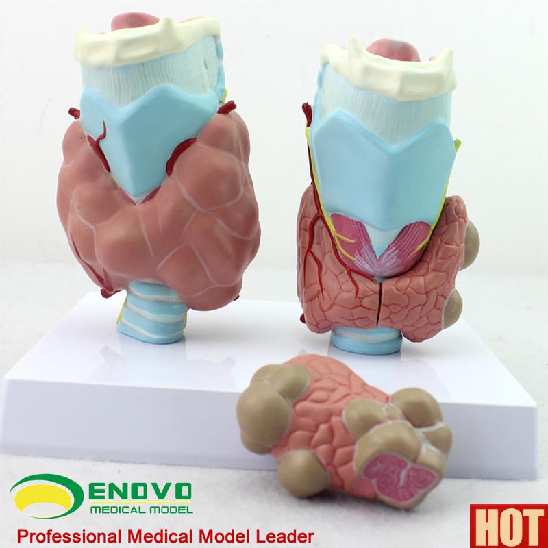 NOVO正品 人体甲状腺病A理模型甲亢甲低甲减 内分泌系统医学解剖