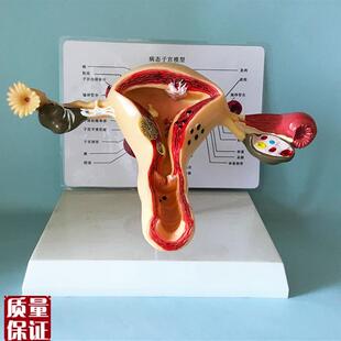 子宫模型生殖器女性器s官解剖人体教学教仪医用教具包邮厂家直