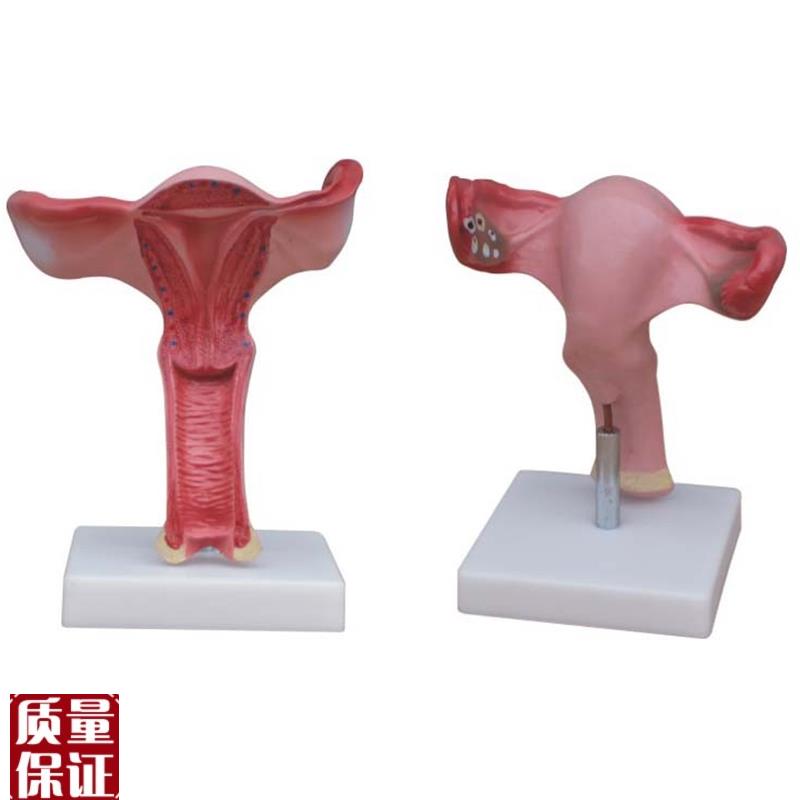 高级子宫放大模型女性生殖系统解剖模型O/人体模型/美院专
