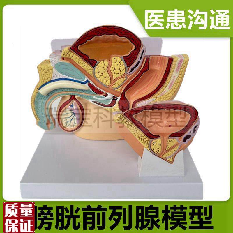 前列腺模型病理增肥尿道狭窄男科医患生殖泌尿器官W临床教医药礼
