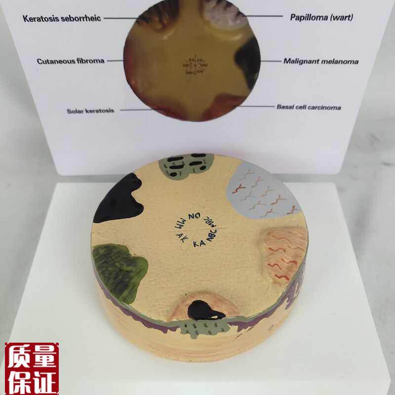 人体皮肤解剖模l型病理皮肤演示皮肤科教具多症状皮肤病演