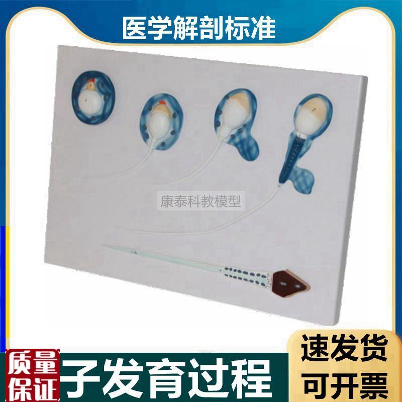 精子模型男d性生殖精子生长发育过程睾丸解剖放大输精管男科医患