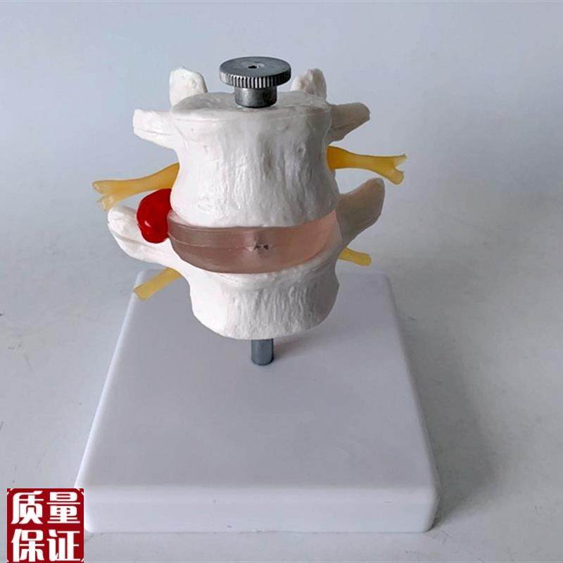 脊柱模型可拆卸腰椎带神经腰椎间盘G仿真塑料骨髅头正骨教学推
