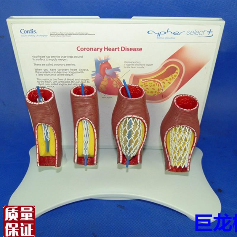 人体血管堵塞支架模型人体心脑血管堵塞教学模R型人体支架解剖模