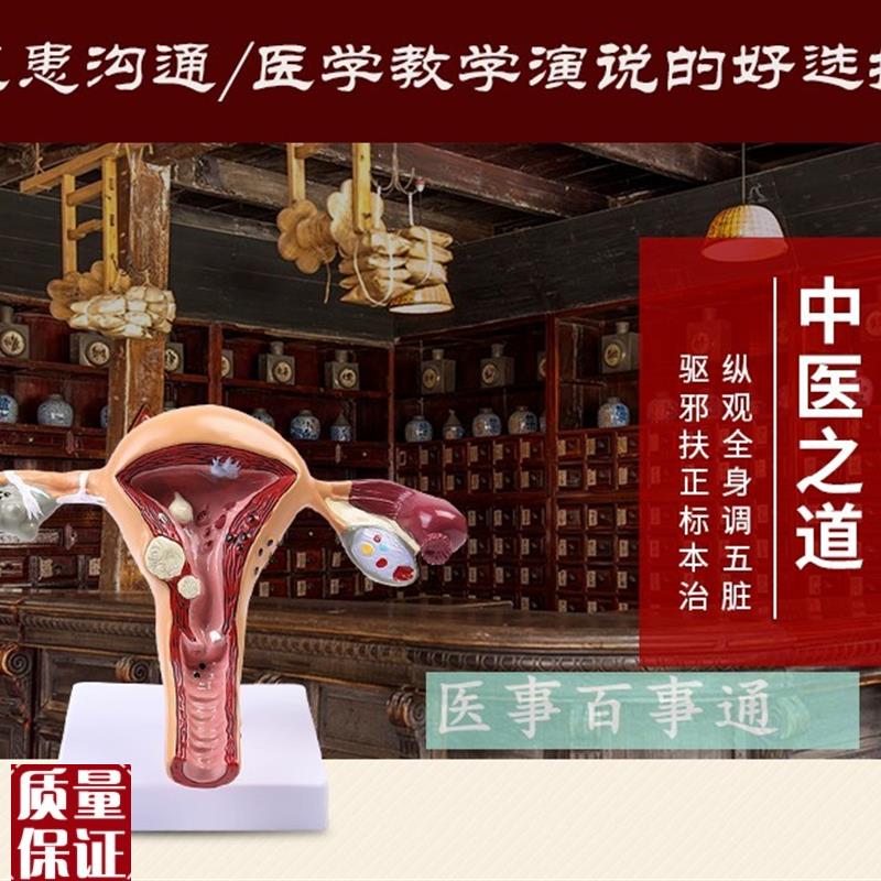 人体子宫解剖模型子宫模型子宫癌变输卵管狭窄综合Z疾病科普教