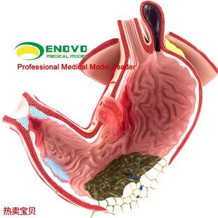 颐诺正品医用胃部n疾病演示模型人体胃解剖消化系统模型消化科