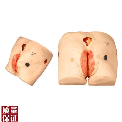 上海医模H17E高级压疮(褥疮)护理模型M操作练习训练医学教学臀