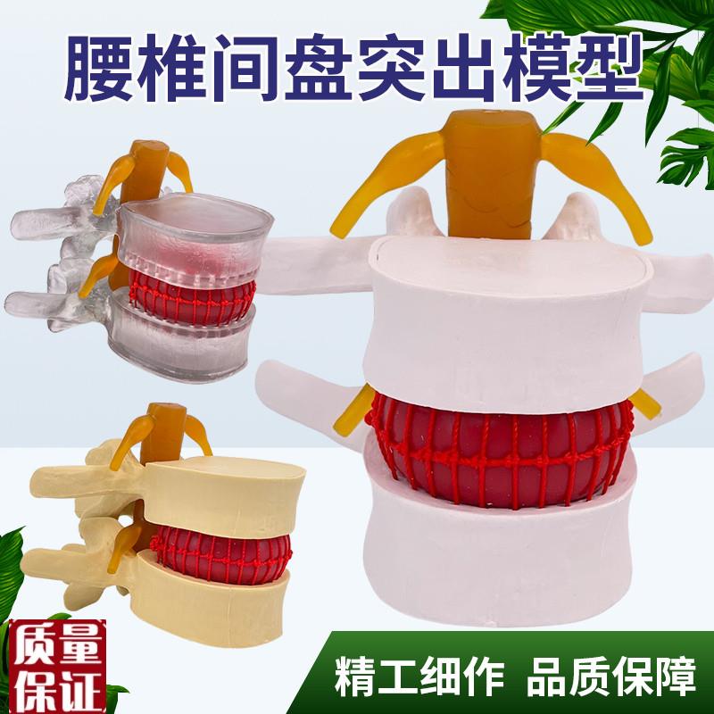 特价腰椎间模型放大1.5倍腰椎受G压演示模型教学医学腰椎模