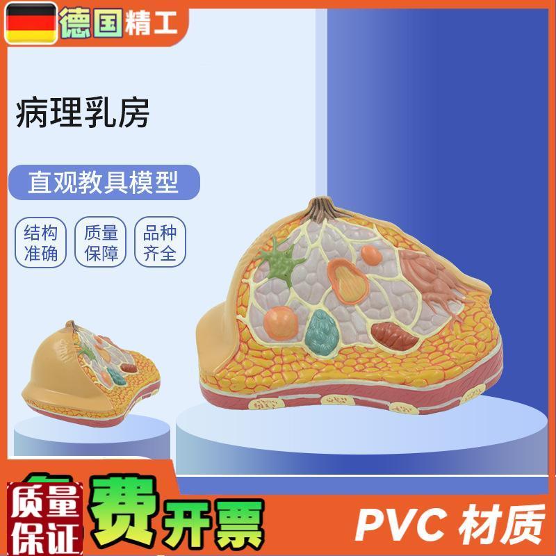 德国】PNT-0740妇科乳房解剖模型乳房P病理解剖乳房结构模