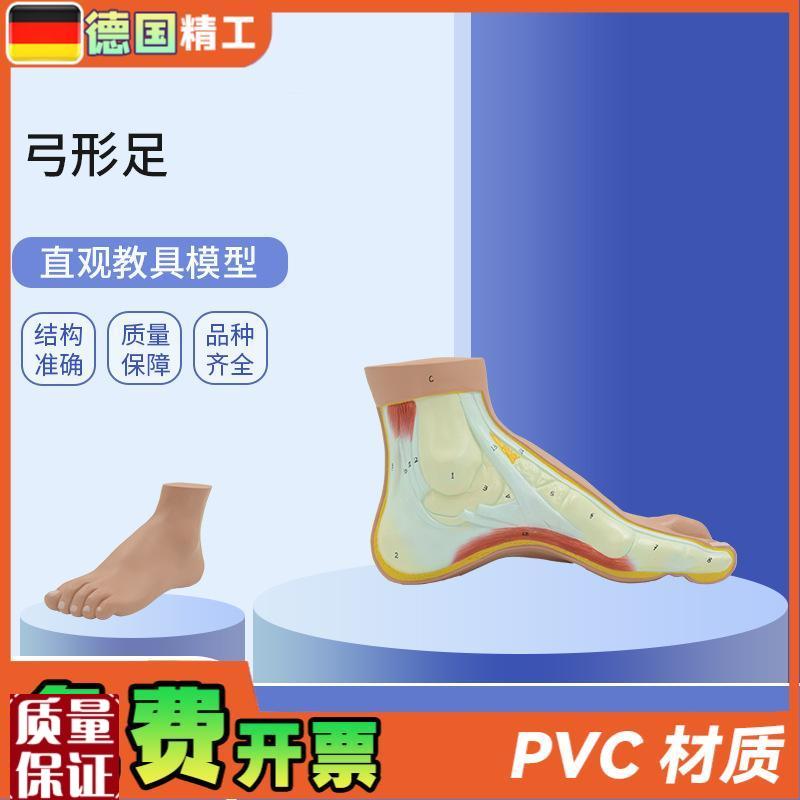 德国】PNT-0727弓形x足模型足部病理模型人体足部解剖模型脚