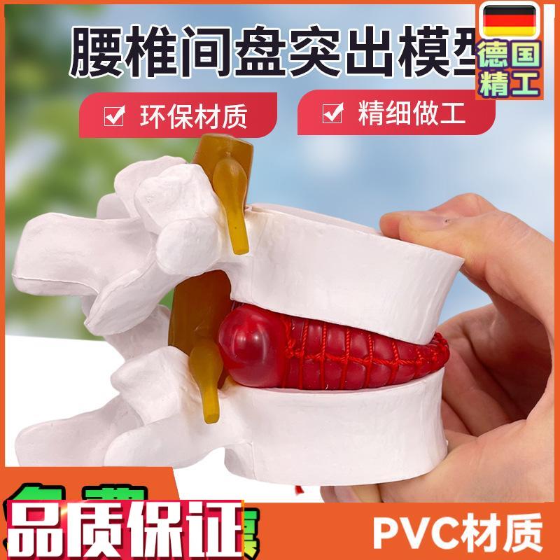 腰椎放大腰椎间盘受压演示模型人C体脊柱脊椎骨病理演示关节医学