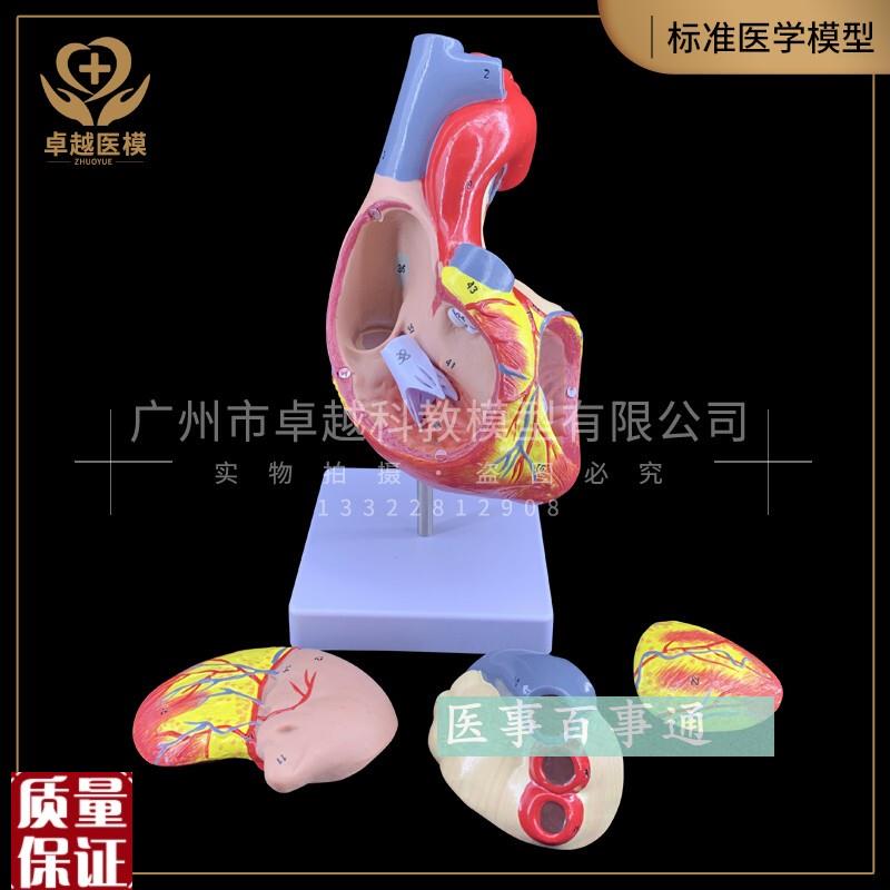 大心脏解剖模型新型2.5倍放大人体心脏模Q型人体模型内脏解
