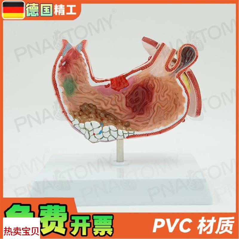 德国】人体胃结构消化系r统解剖模型病理展示标本医学内脏器官消