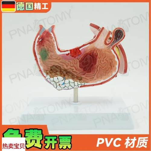 德国】人体胃结构消化系r统解剖模型病理展示标本医学内脏器官消