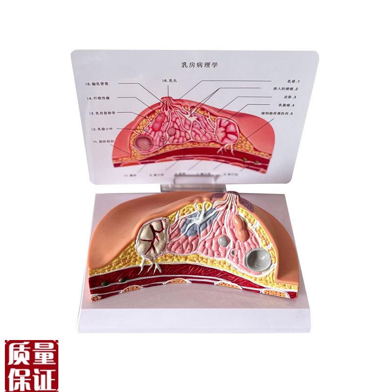 乳房模型乳腺增生家政培训妇产乳腺演示哺乳期乳T房构造催乳师教