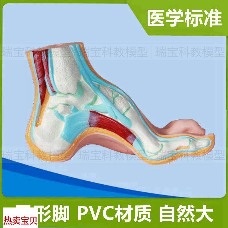 弓形足模型脚h部畸形平足畸形爪形足高弓足人体脚骨仿真1:1