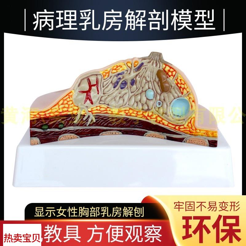 乳房模型胸部解剖模型静止期哺乳期女性病变乳P腺结构乳房医学教
