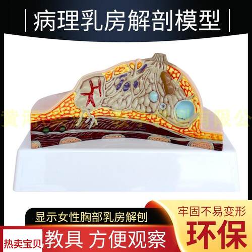 乳房模型胸部解剖模型静止期哺乳期女性病变乳P腺结构乳房医学教