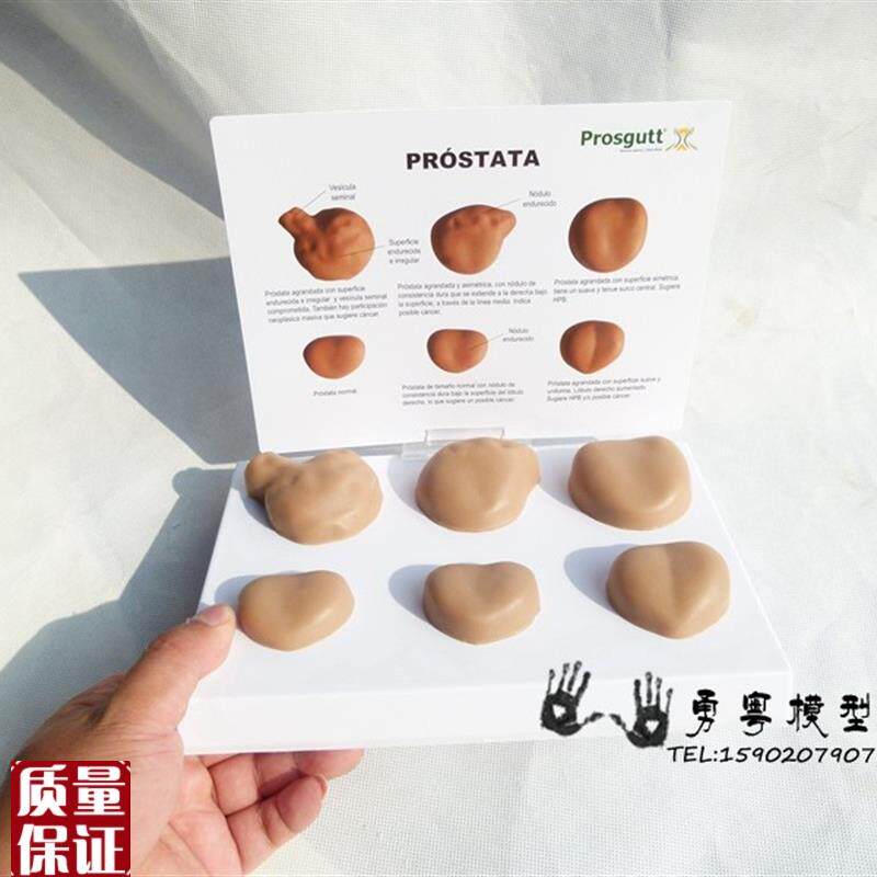 男性前列腺模型病症前列腺x模型人体模型生殖泌尿系统男科教