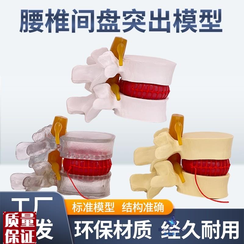 教学仿真人体腰椎间盘演示突出模型脊柱L测压演示脊椎压力病变脊