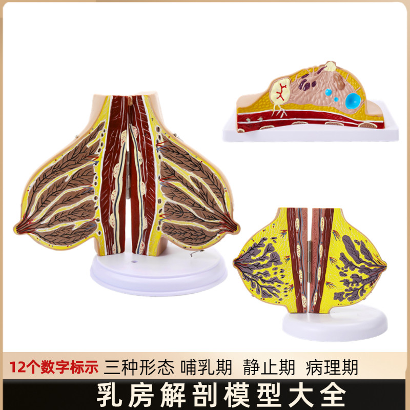 哺乳期乳房e模型胸部解剖乳房结构造乳房乳腺病变模型催乳师教具